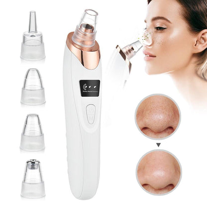 Beauty Electric Blackhead Remover - All In The Bag 